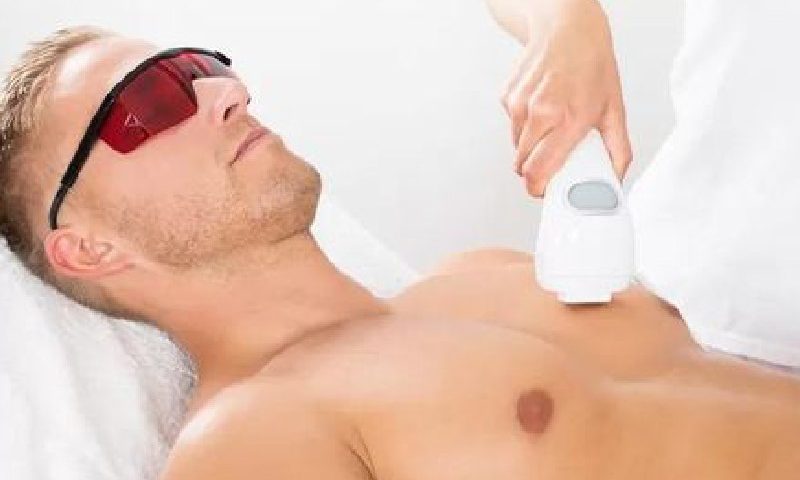 لیزر فول بادی