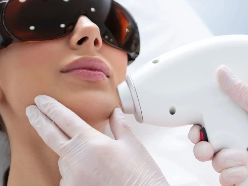 لیزر فول بادی چیست؟