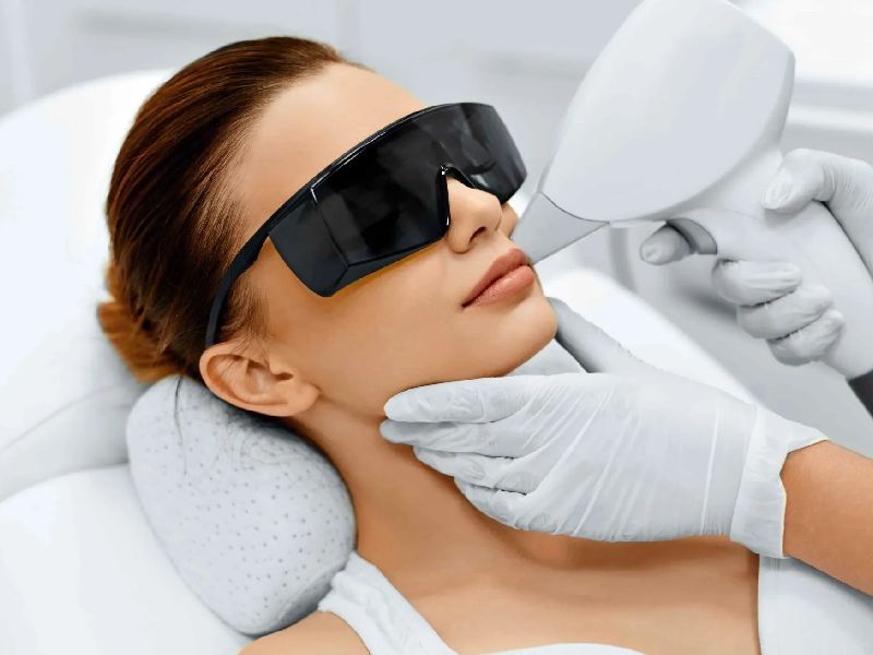 مراقبت بعد از جلسه اول لیزر