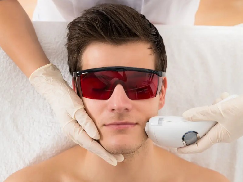 تعداد جلسات لیزر موهای زائد 